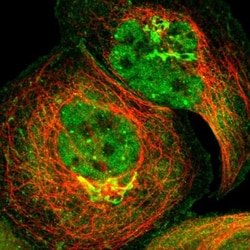 ZNF18 Antibody, Novus Biologicals:Antibodies:Primary Antibodies